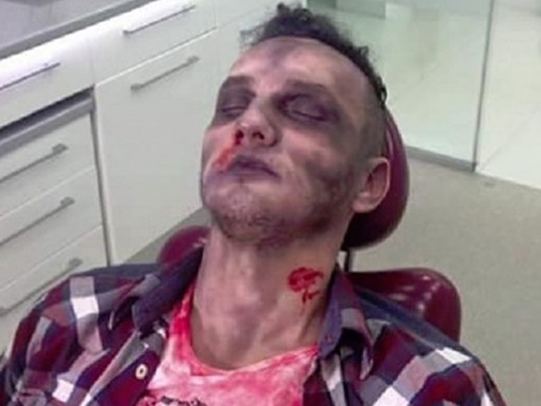 Mihai Trăistariu a şocat fanii, postând pe facebook o fotografie în care arată ca un zombie.