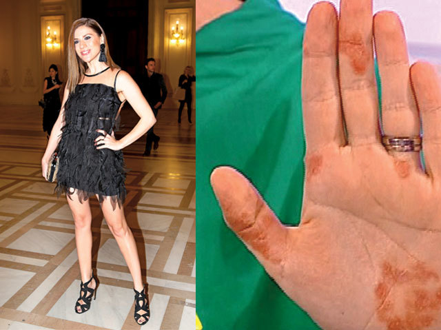 Actriţa Tili Niculaie suferă de o boală incurabilă