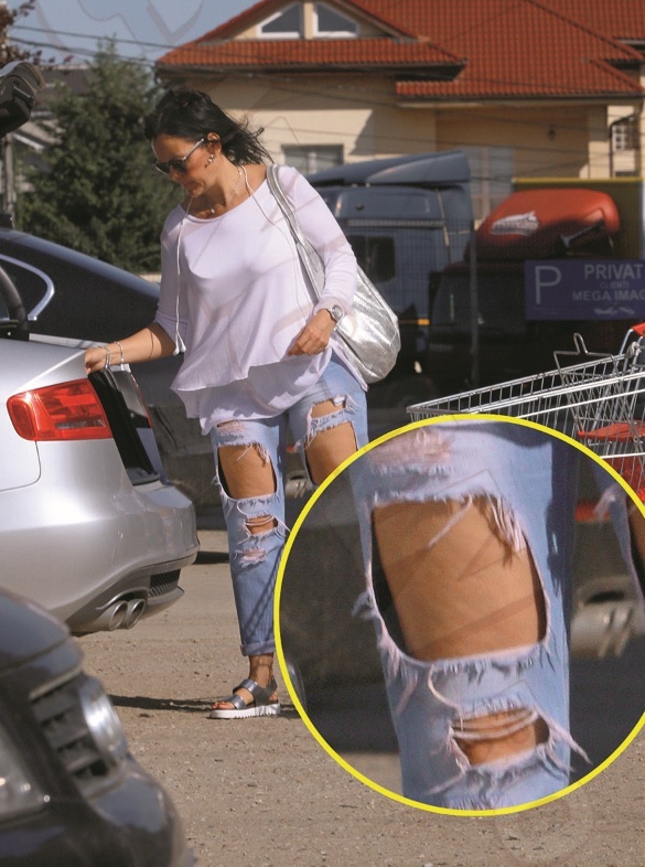 Manuela are probleme cu celulita