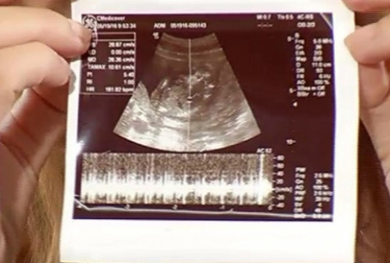 Prezentatoarea a făcut şi prima ecografie