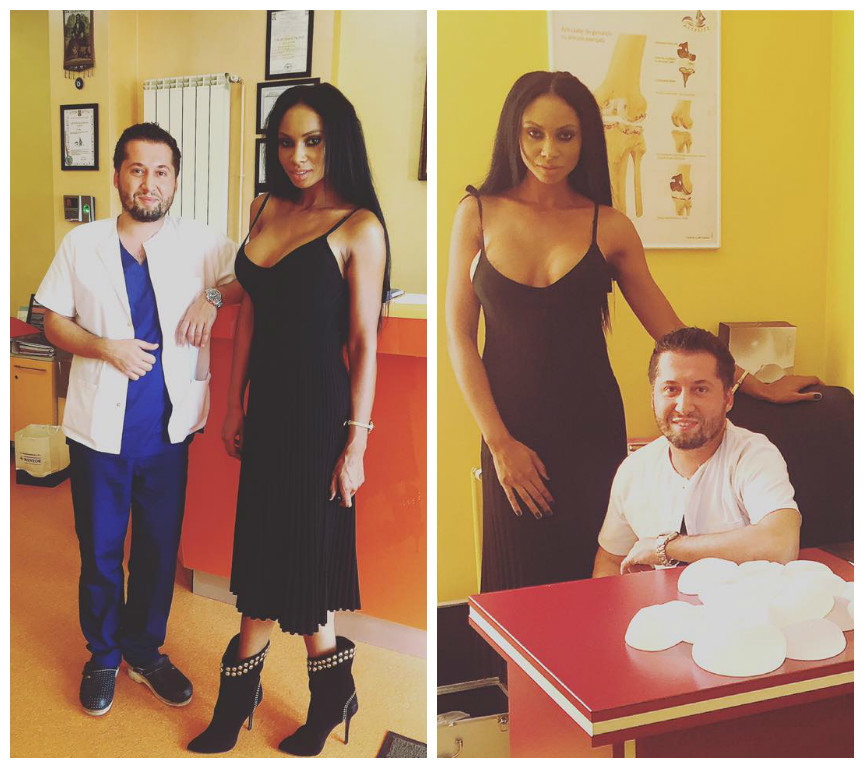 Laurette îşi micşorează sânii.