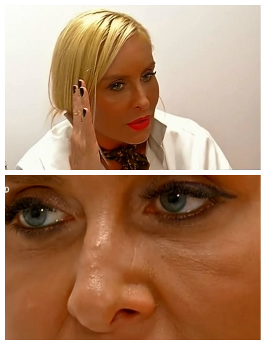 Vica vrea să îşi opereze nasul.