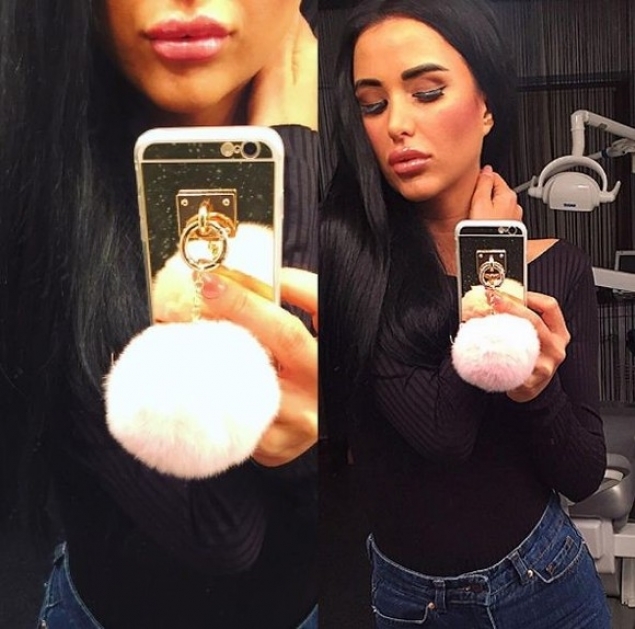 Daniela Crudu şi-a mărit buzele.