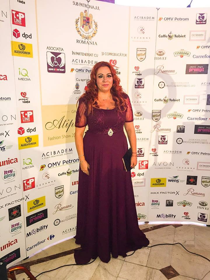 Oana Roman neagă că şi-ar fi micşorat stomacul.