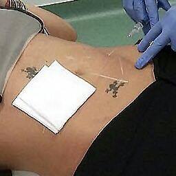 Anamaria Prodan apelează la diferite tratamente pentru a arăta bine.