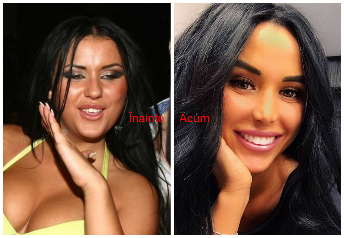 Daniela Crudu, total schimbată după operaţiile estetice.