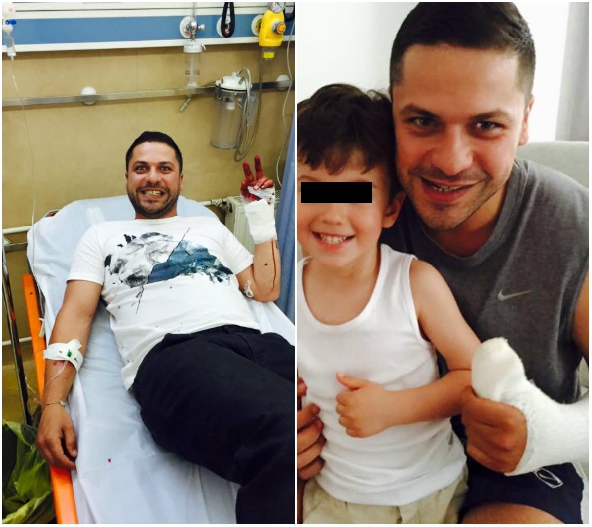 Augustin Viziru, după ce s-a tăiat la mână cu toporul în timpul reality-showului ”Ferma vedetelor”