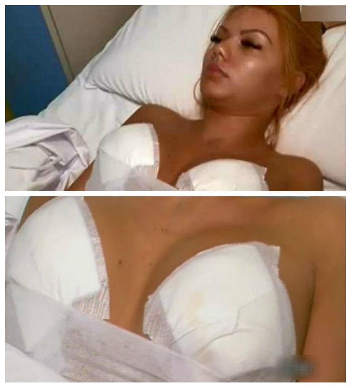 Beyonce de România şi-a schimbat implanturile mamare.