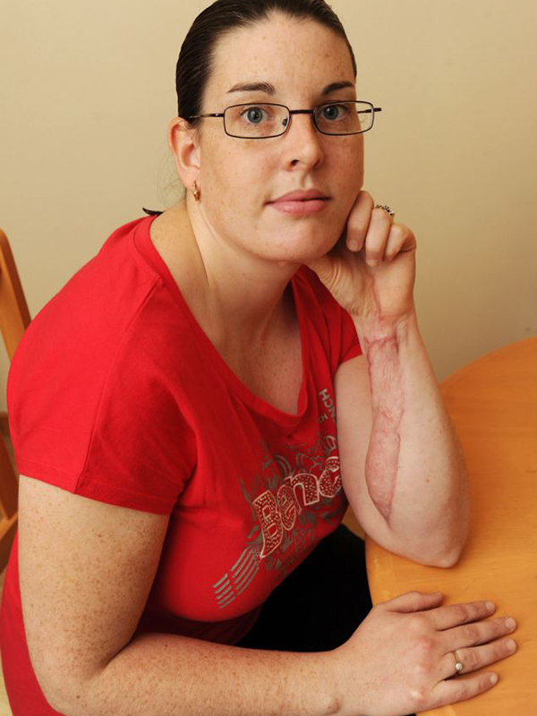 Norocoasă că a supravieţuit! Uite ce i-a putut face o simplă muşcătură de paianjen!