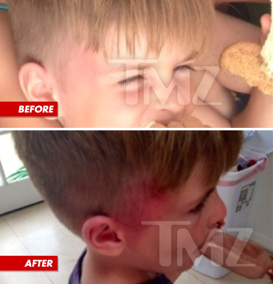 copilul lui Charlie Sheen ranit