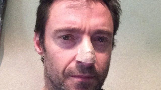Hugh Jackman