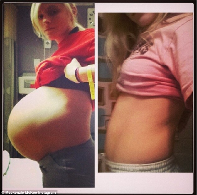 Asa arataMackenzie McKee la doua saptamani dupa nastere