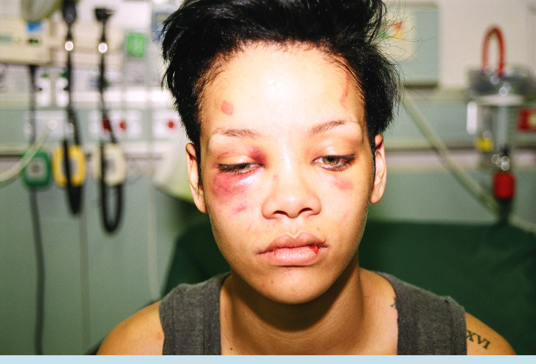 Asa arata Rihanna dupa ce a fost batuta de Chris Brown