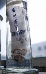 Organul sexual al celrului talhar se afla acum conservat de muzeul Institutului de Medicina Legala din Bucuresti