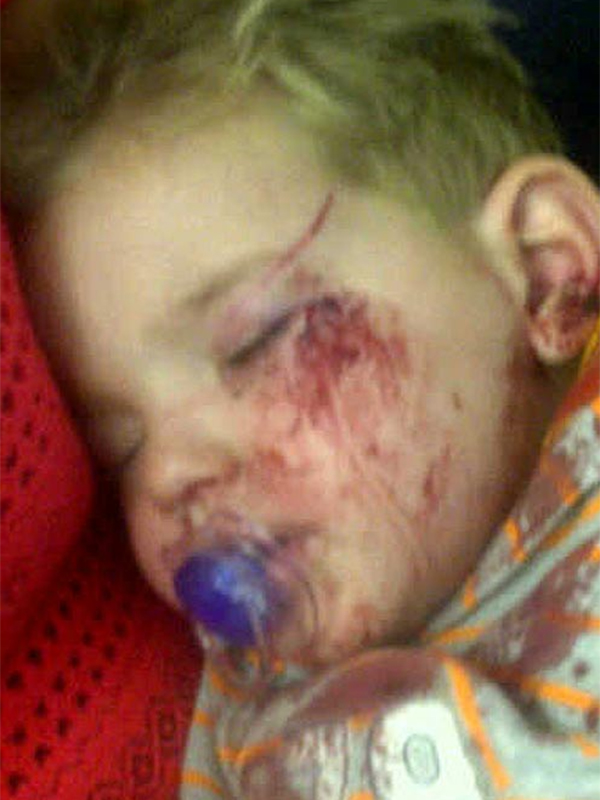 Incredibil! Un copilaş de doar doi anişori a fost desfigurat de un vultur! Află cum a fost posibil!