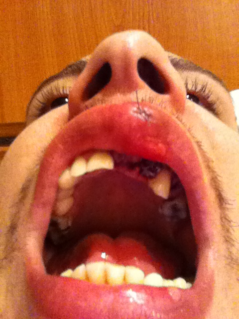 Asa arata Liviu Dovleac la scurt timp dupa ce a fost batut