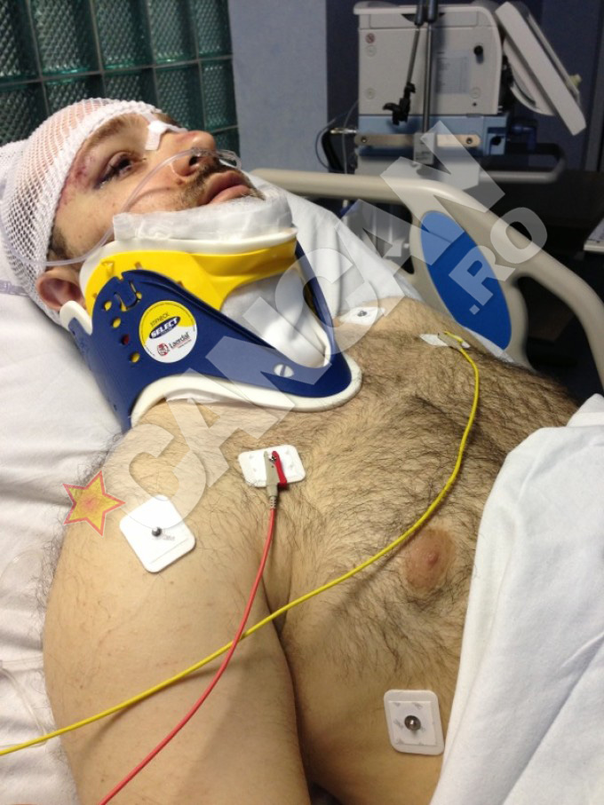 Andrei Tirdea a fost batut mar in ianuarie 2013