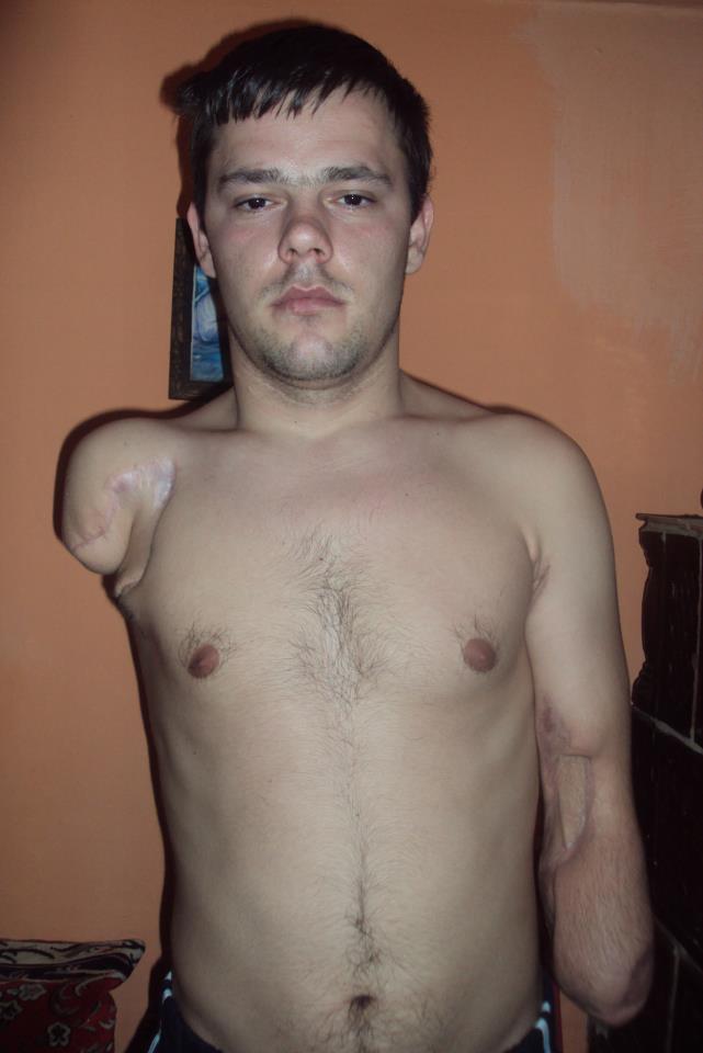 Costinel a ramas fara maini dupa ce s-a curentat