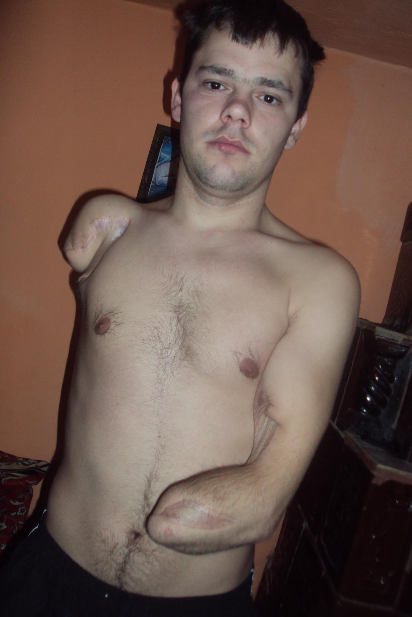 Costinel a ramas fara maini dupa ce s-a curentat