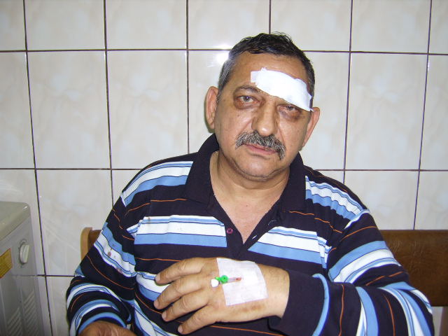 Doru, soferul de la RATB, a avut nevoie de ingrijiri medicale