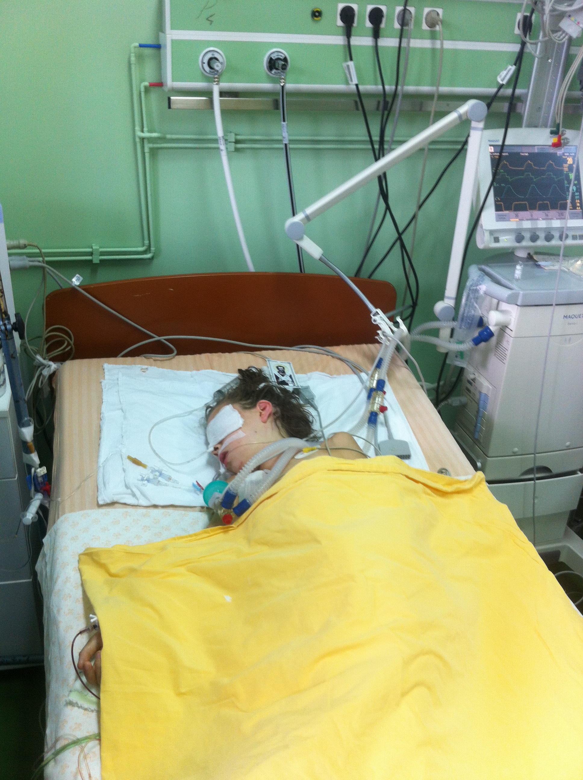 Iulia se afla in moarte cerebrala