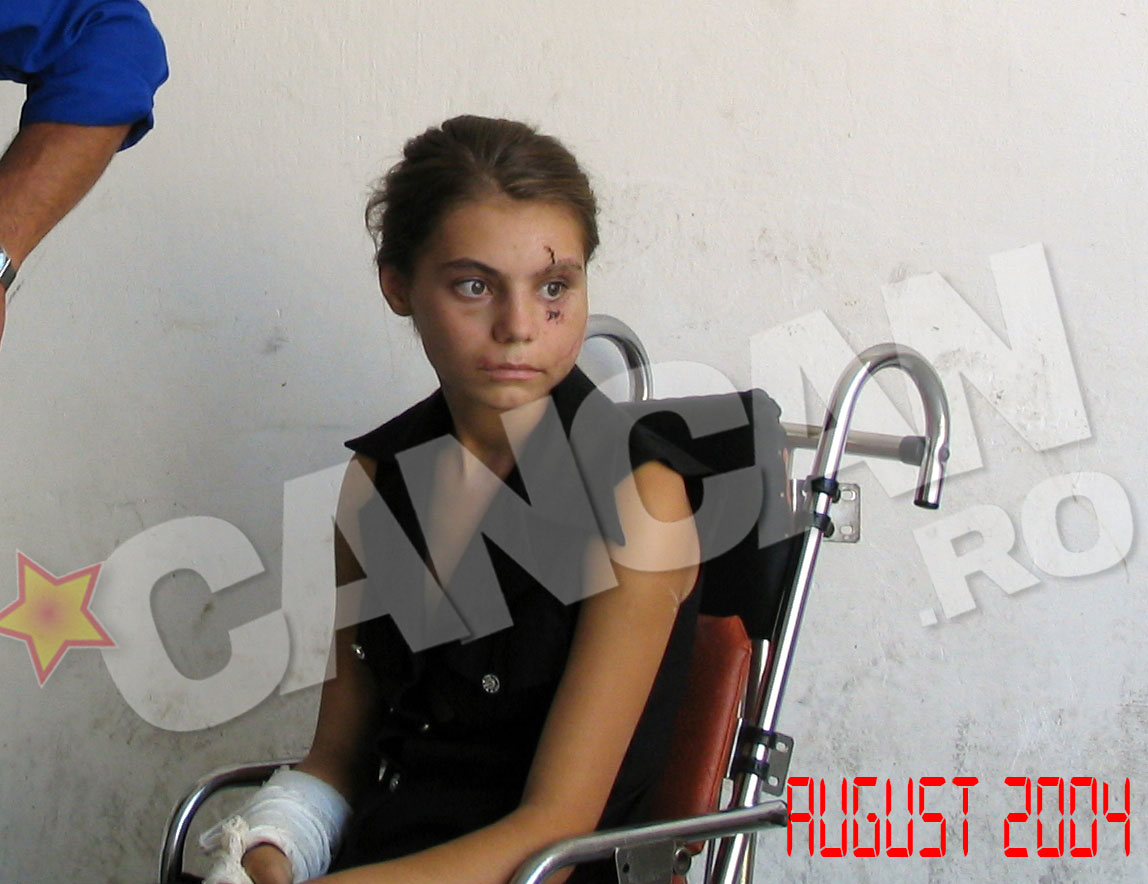 Dupa accident, Silvia a stat cateva saptamani in coma