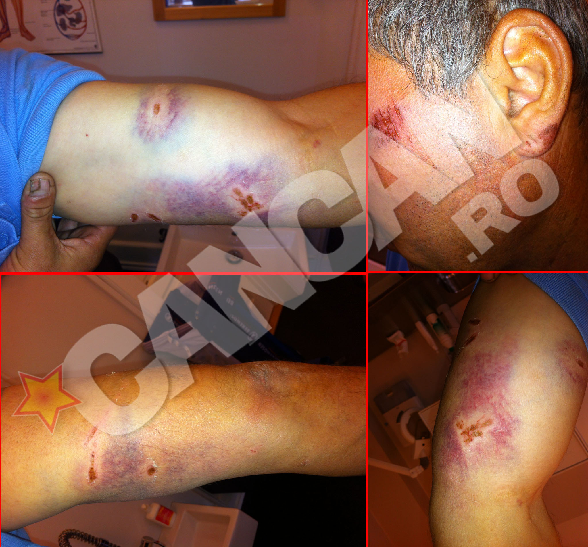 Romanul a fost mutilat de cainii Politiei