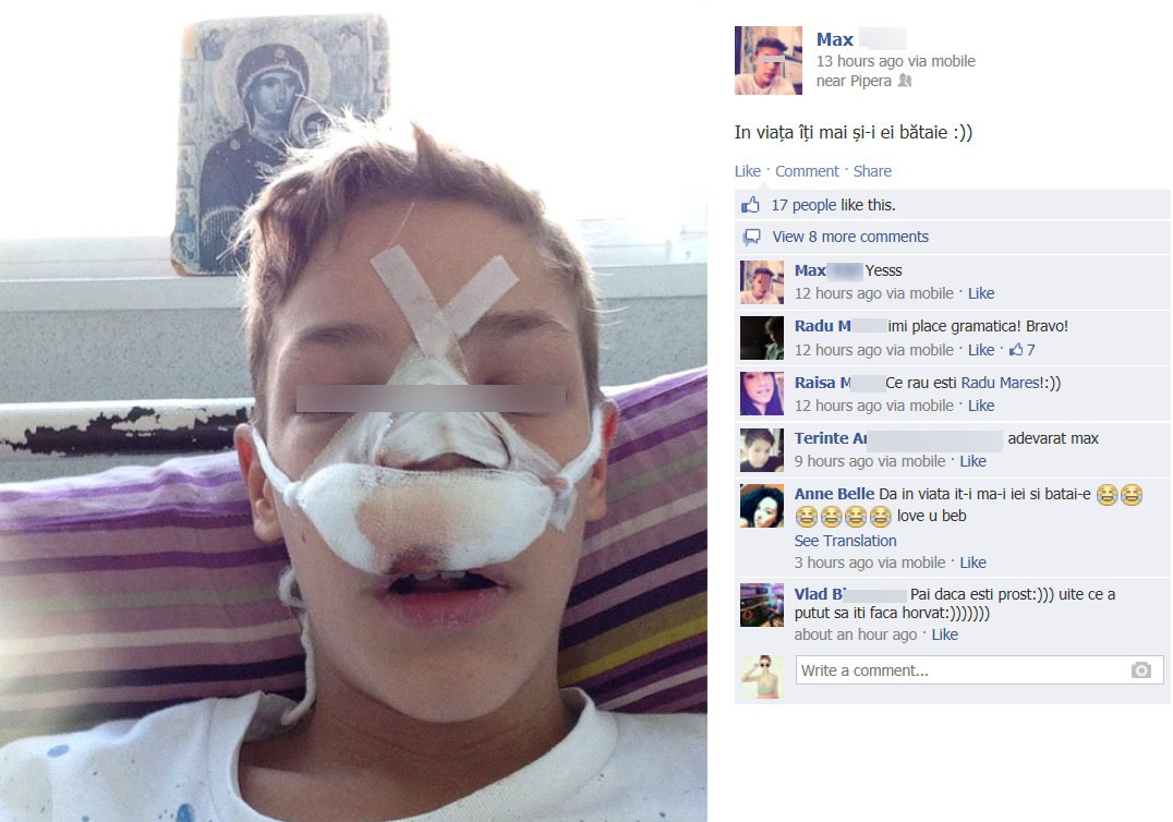 Prietenii lui Max l-au ironizat, desi se afla in suferinta