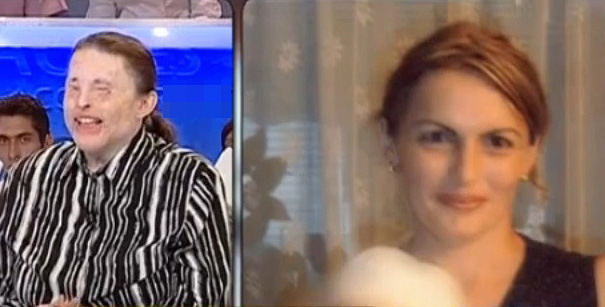 Elena s-a resemnat cu ideea ca nu-si va mai recapata trasaturile frumoase, iar tot ce isi doreste este sa poata vedea din nou