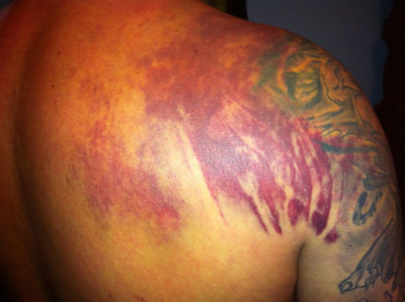 Barbatul sustine ca a fost lovit de politisti si jandarmi