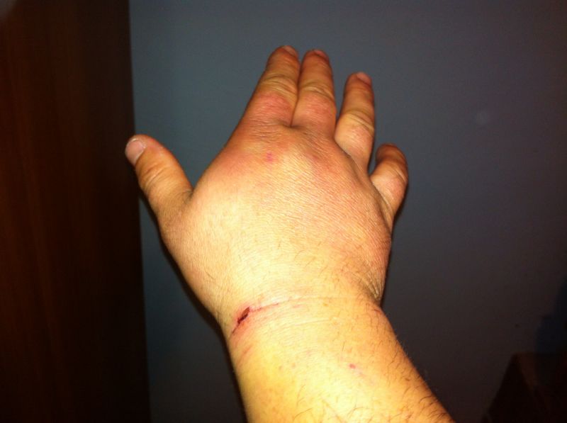 Barbatul sustine ca a fost lovit de politisti si jandarmi