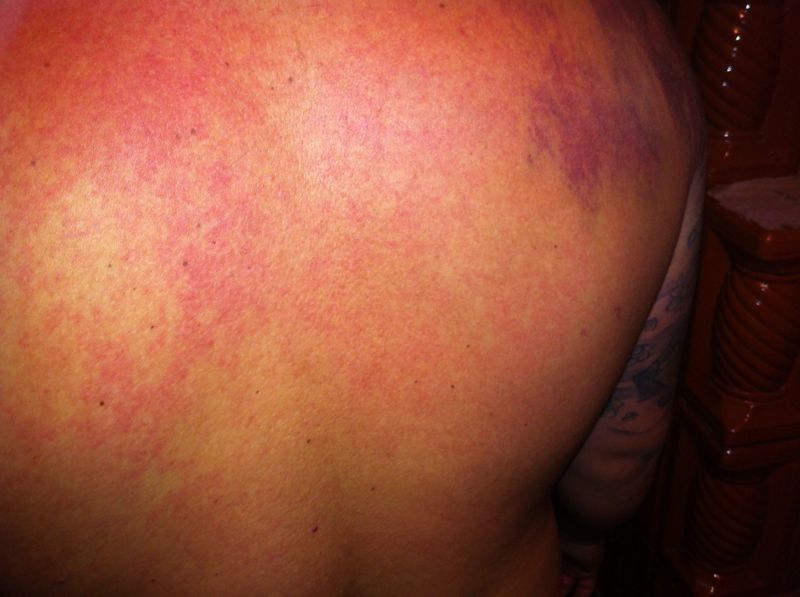 Barbatul sustine ca a fost lovit de politisti si jandarmi