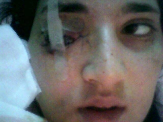 Daniela a fost impuscata in ochi de catre Marius Chirita