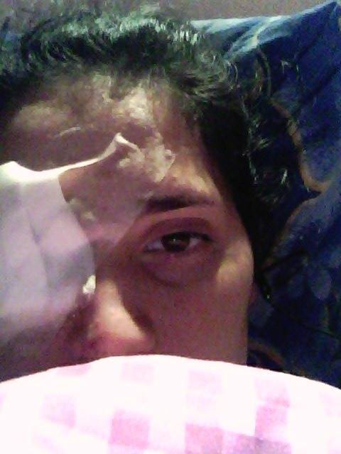 Daniela si-a pierdut ochiul drept