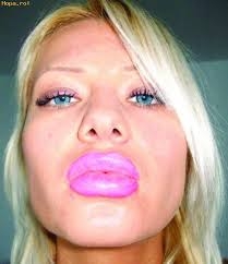 Vedete cu acnee - 13