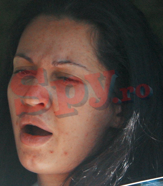 Vedete cu acnee - 11