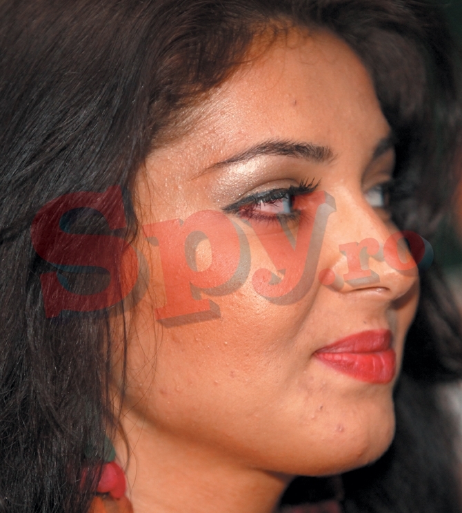 Vedete cu acnee - 10