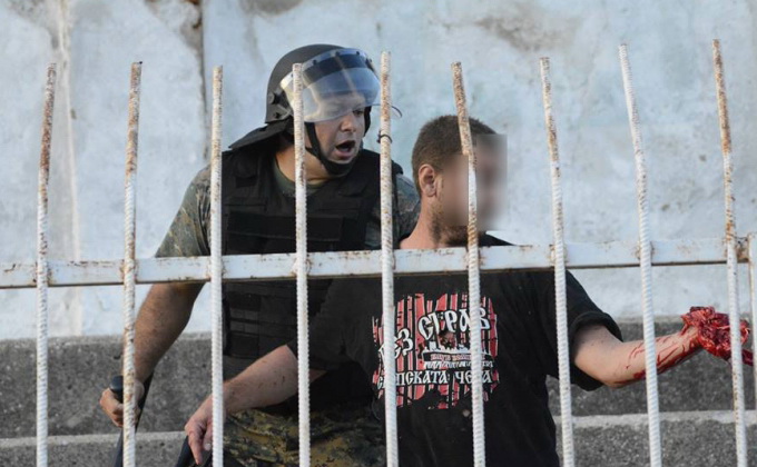 Ultrasul macedonean a mers pe picioarele lui la medici