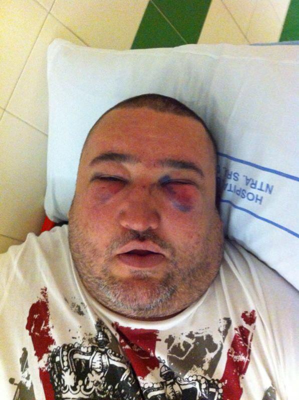 Robert a murit in urma unei lovituri fatale