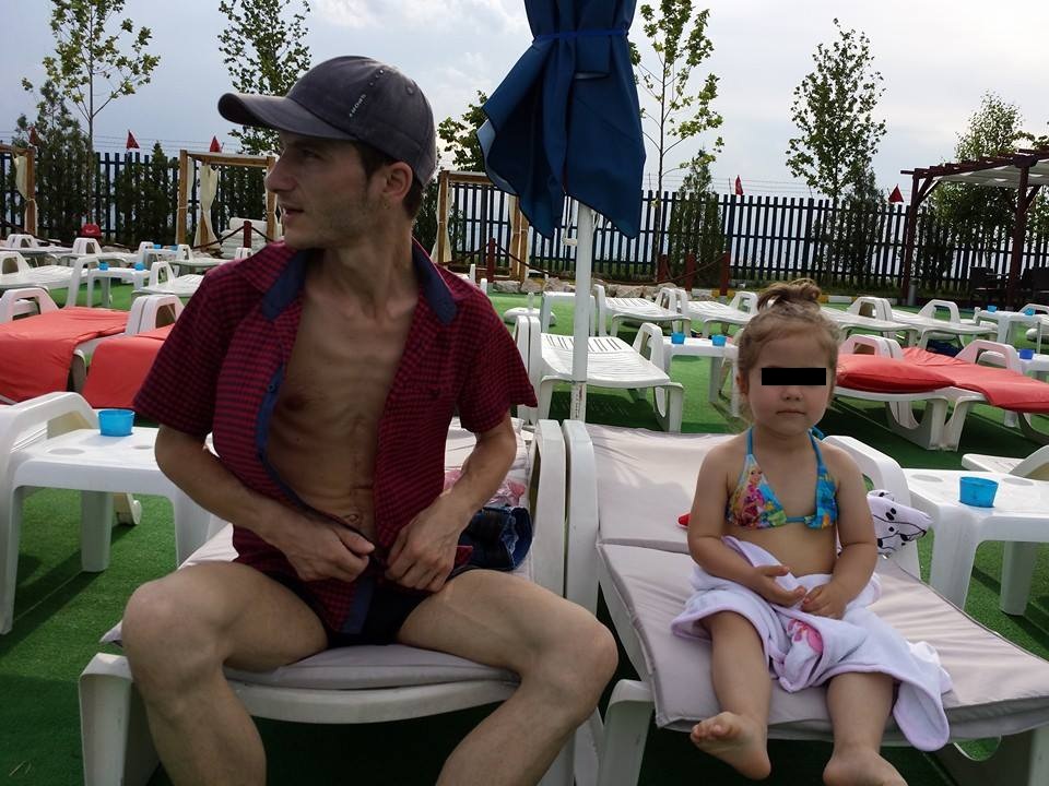 Taticul a ajuns numai piele si os in urma operatiei