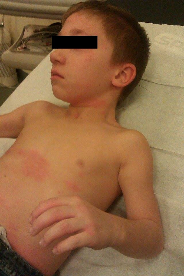 Baietelul a ajuns in stare grava la spital