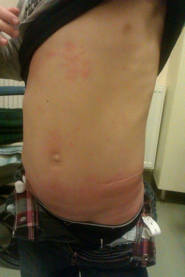 Baietelul a ajuns in stare grava la spital