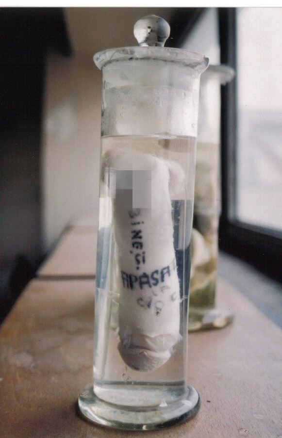 Penisul lui Terente este tinut la loc de cinste in Muzeul IML