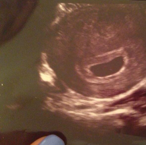 Oana a postat ecografia pe pagina ei de Facebook