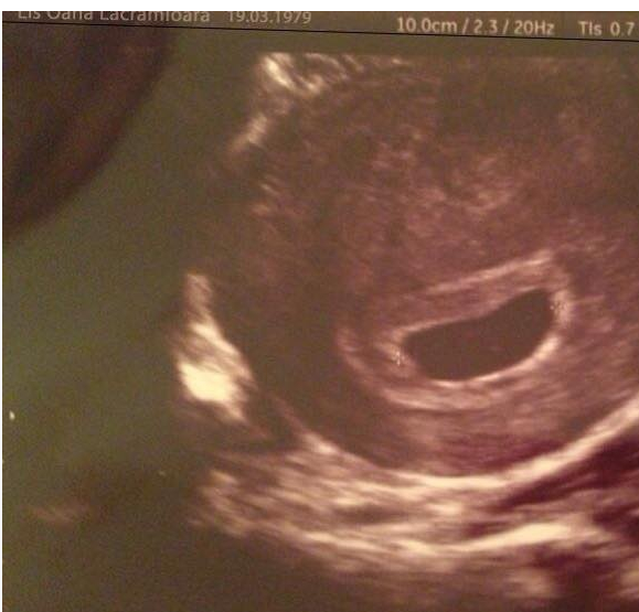 Pe ecografie scrie si al doilea nume al Oanei