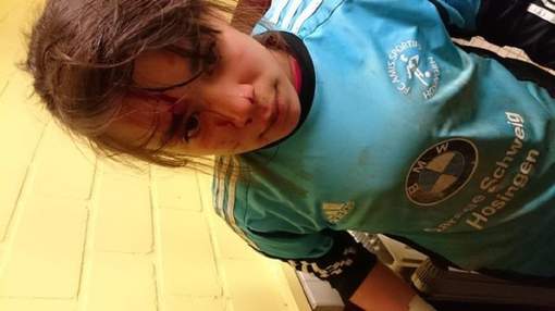 Jucatoarele s-au luat la bataie (foto:7sur7.be)