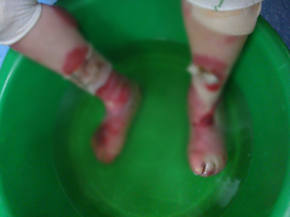 Emanuel indura zilnic dureri insuportabile