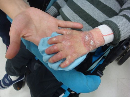 Asa arata manutele lui Emi