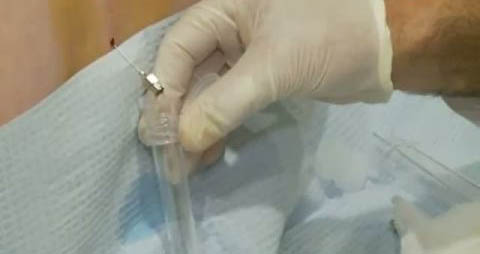 Medicul le-a facut punctii lombare pacientilor