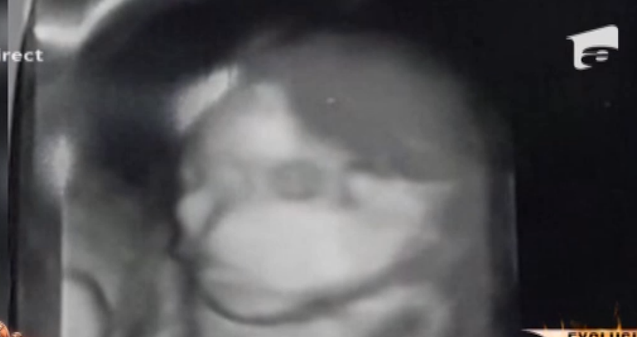 Raluca si-a facut ecografia (foto:antena1)